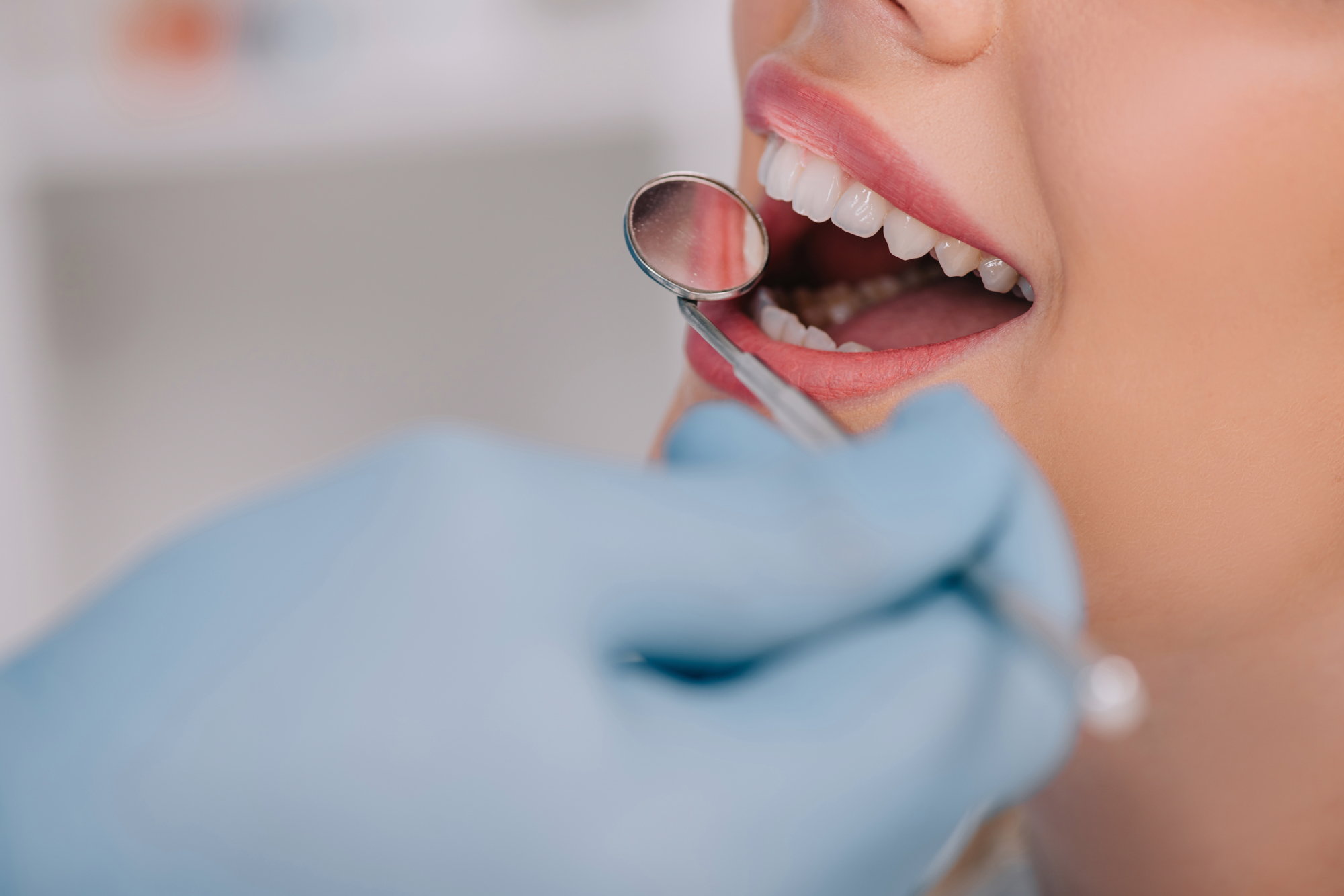 Estetica Dentale: come curare l'aspetto del tuo sorriso